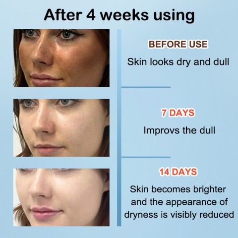 Advanced & Complete Skin Care Regimen And Freebie
