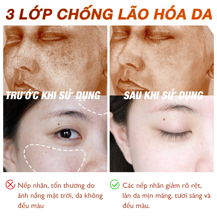 Bộ ba chống lão hóa Ellen Ella