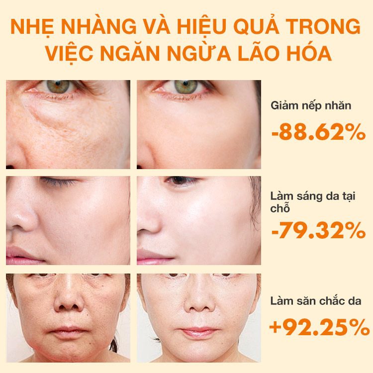 Serum Retinol nâng cấp của Ellen Ella